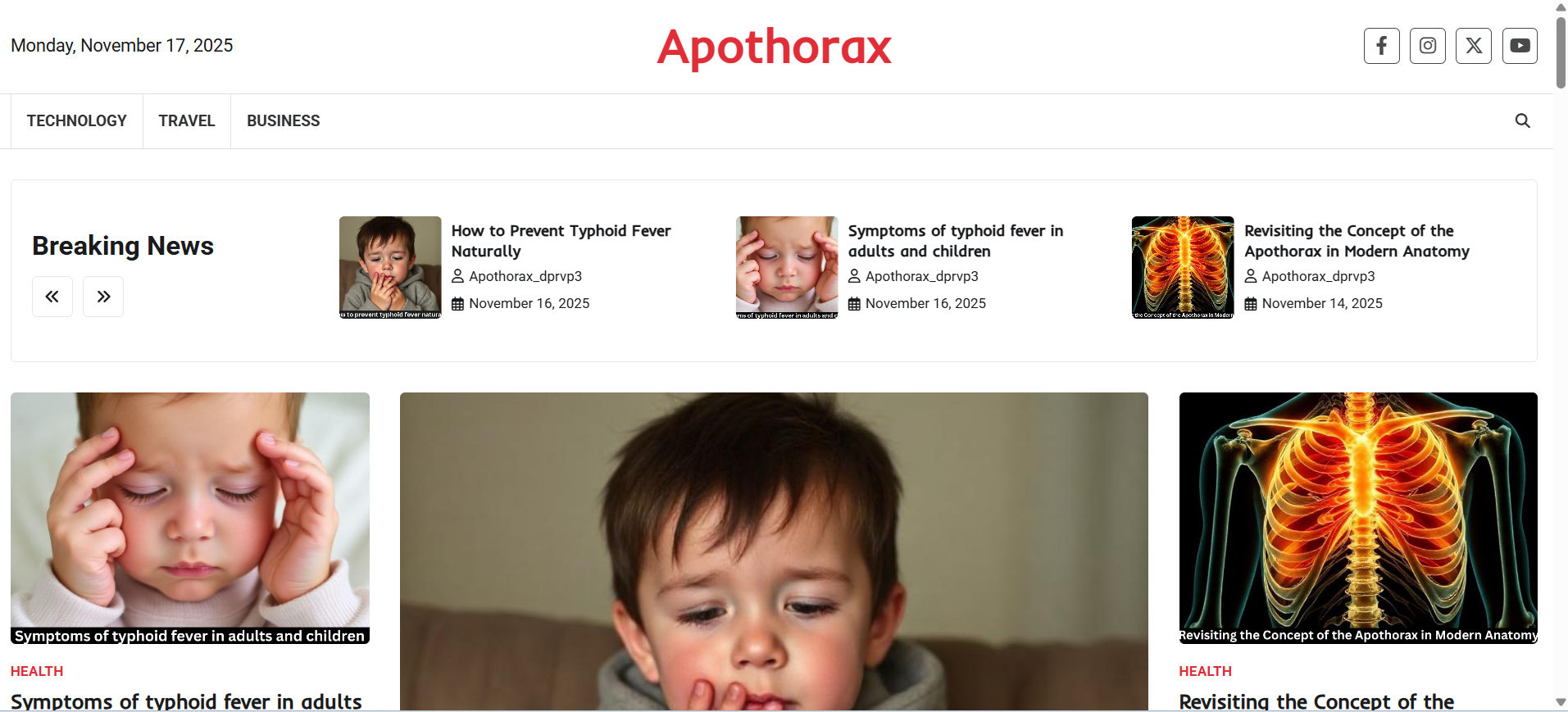 Common Questions About the Apothorax – A Student’s Guide
